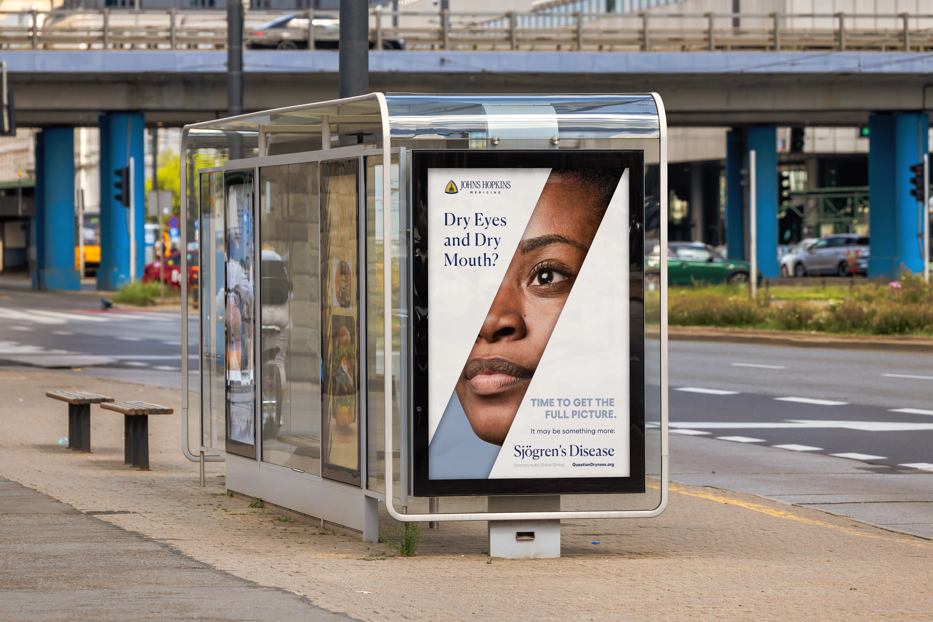 Johns Hopkins Sjögren’s: sjogrens bus shelter 01